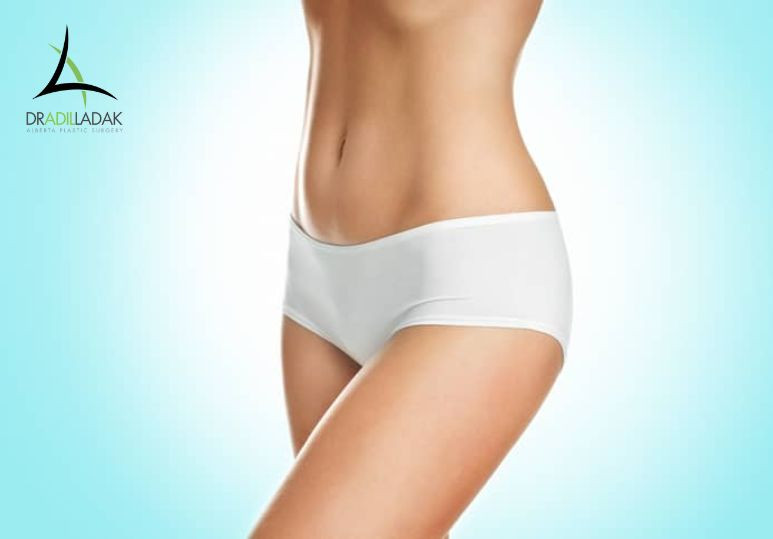 5 Common Questions About Body Contouring